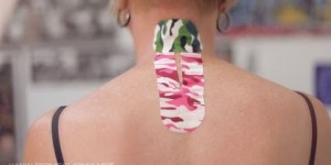 Taping for Neck Pain